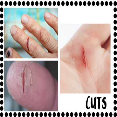 First Aid Basics for Elementary Students: Lesson Plans & Activities